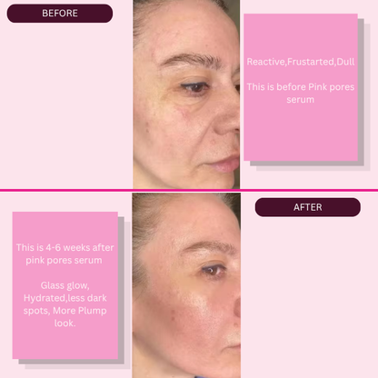 Pink Pores Repair & Glow Serum-Salmon PDRN